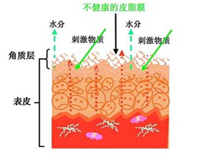广州肤康皮肤病医院