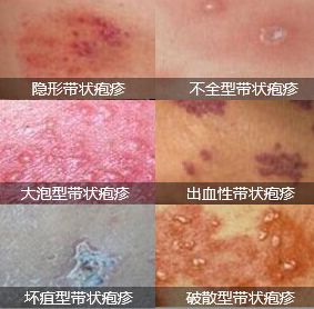 广州肤康皮肤病医院